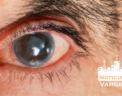 glaucoma
