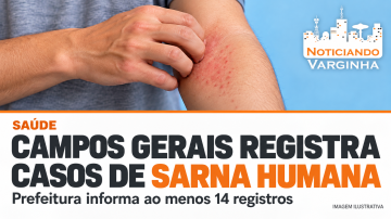 sarnacamposgerais