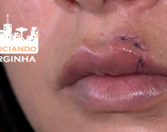 violenciamulher